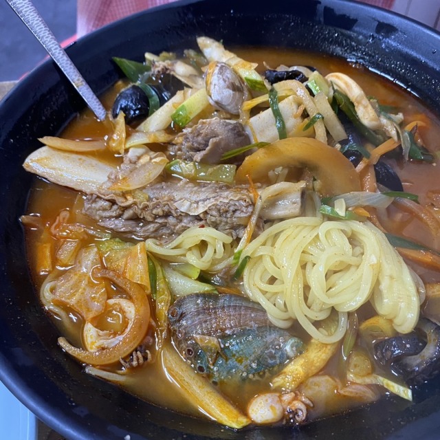 몽고반점 사진