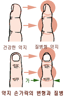 첨부이미지