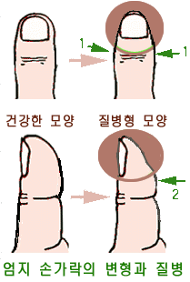 첨부이미지