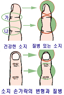 첨부이미지