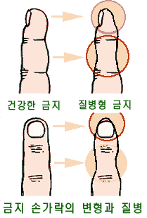 첨부이미지