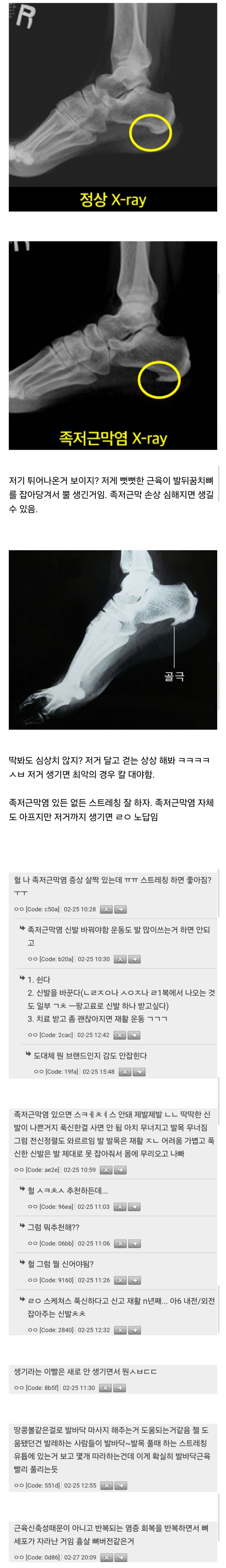 게시글 대표 이미지