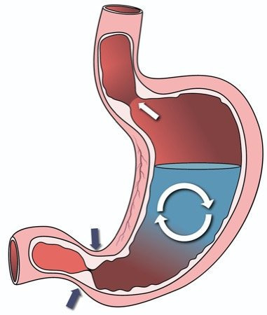 게시글 대표 이미지