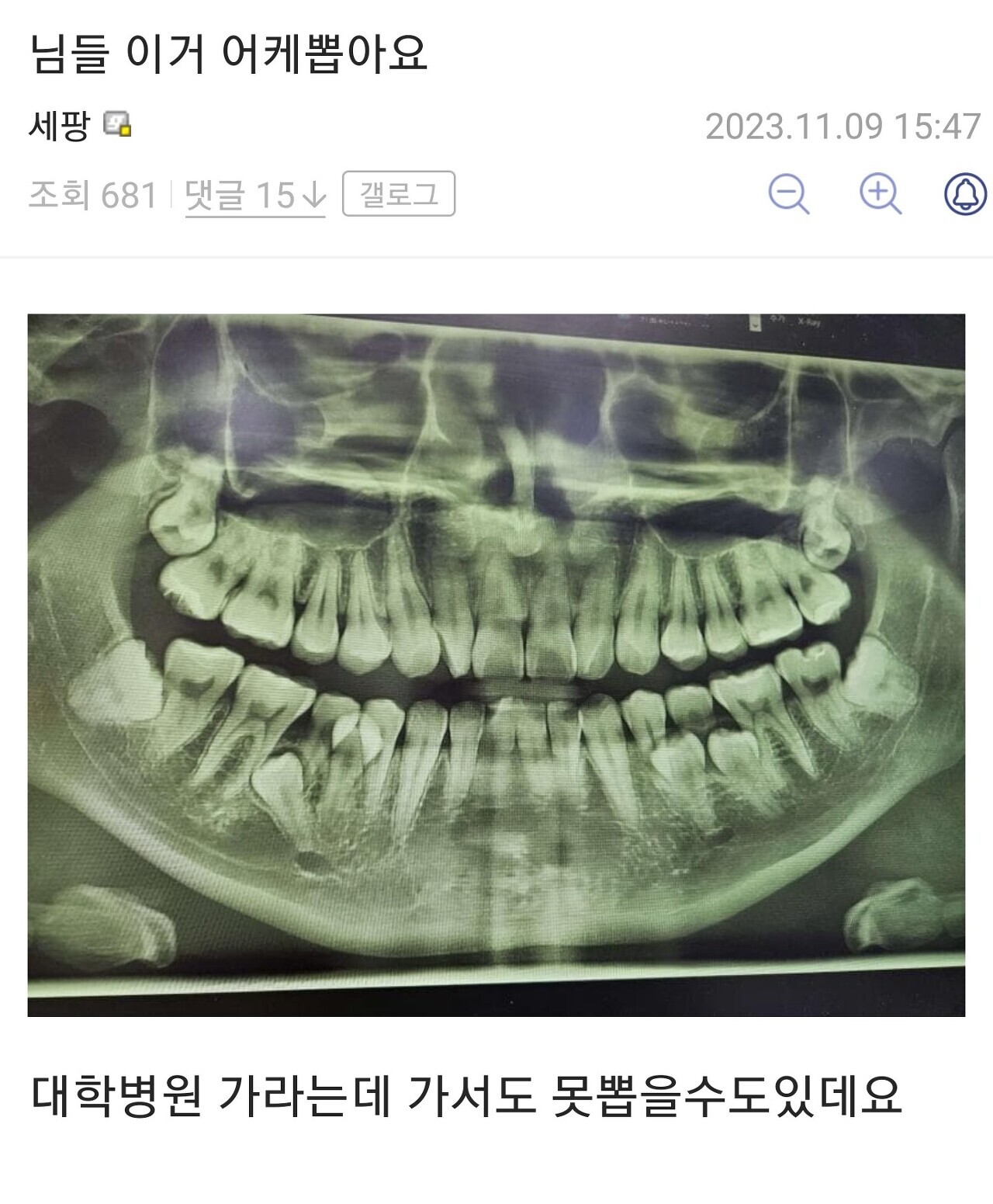 대표이미지