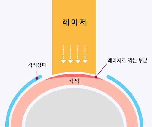 게시글 대표 이미지