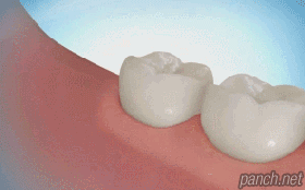 게시글 대표 이미지