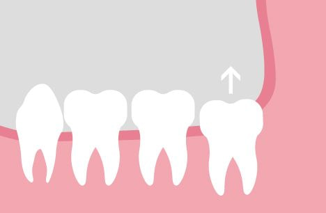 게시글 대표 이미지