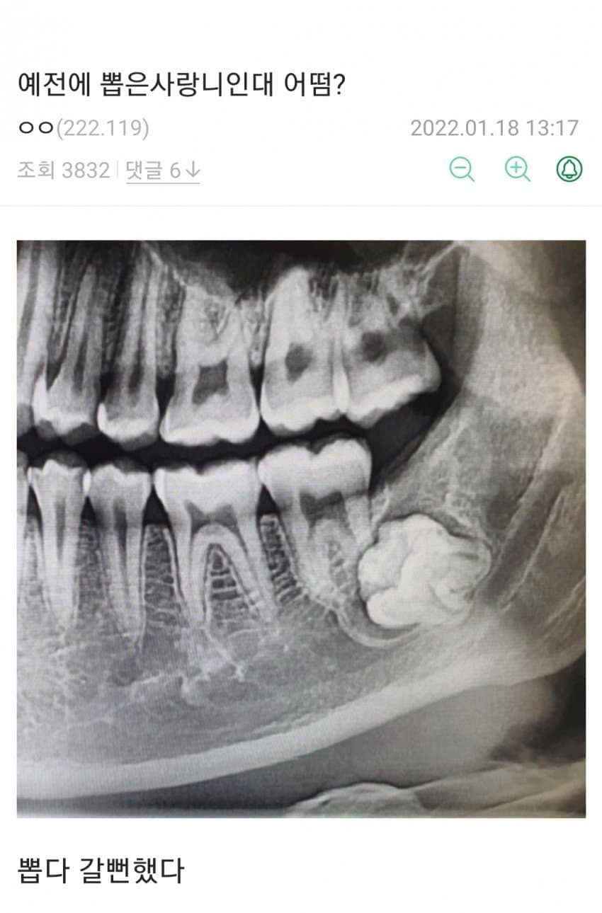 게시글 대표 이미지