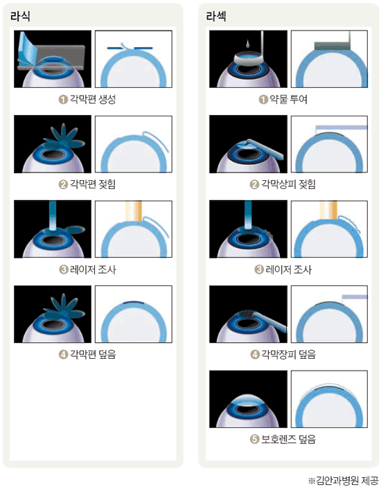 게시글 대표 이미지