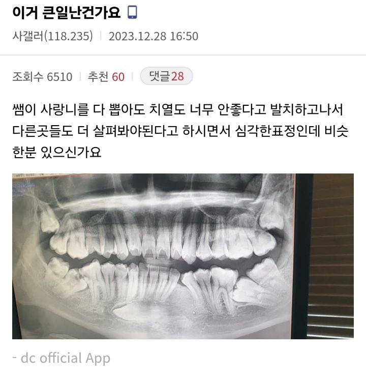 게시글 대표 이미지