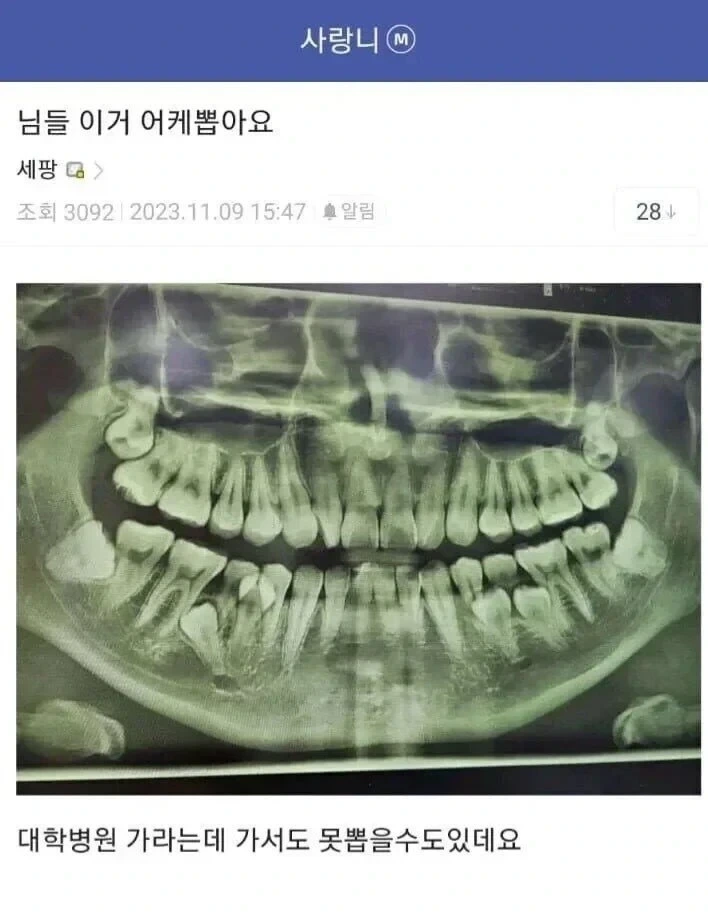게시글 대표 이미지