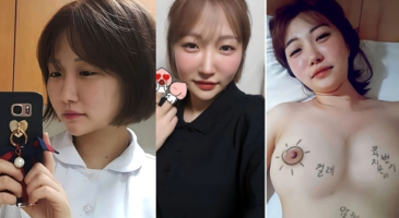 유포 계약서 작성하고 영상 촬영한 간호사