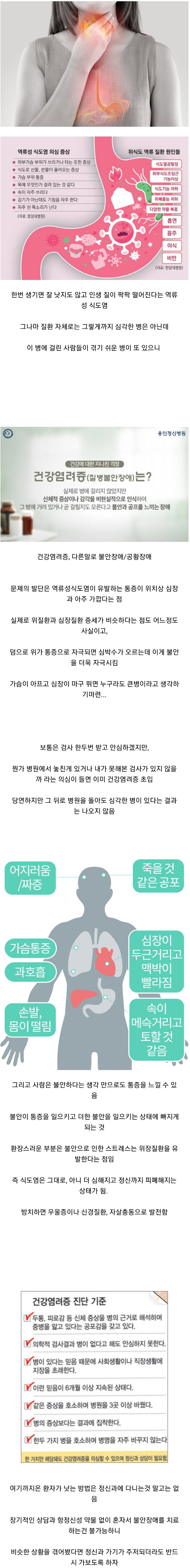 역류성 식도염있는 사람이 걸리면 진짜 답없는 병