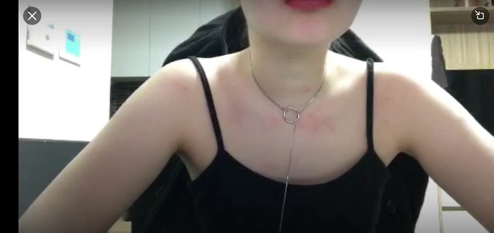 By겨울이 페리스코프 (4)