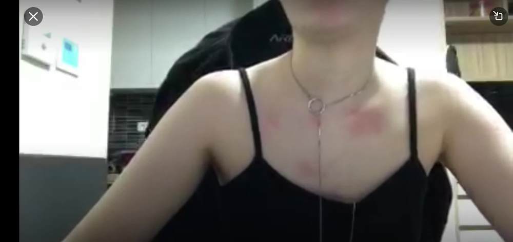 By겨울이 페리스코프 (3)