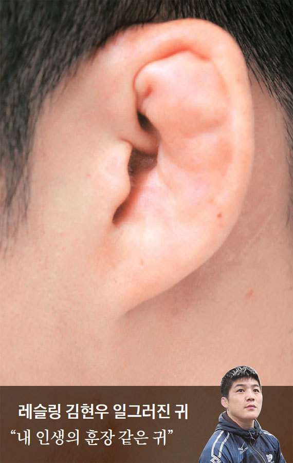 시비 붙으면 안되는 귀