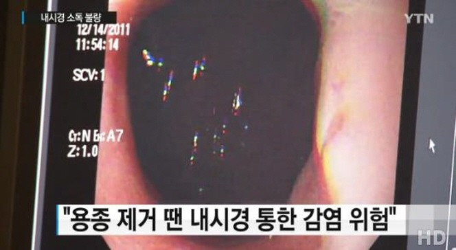 내시경 소독 불량