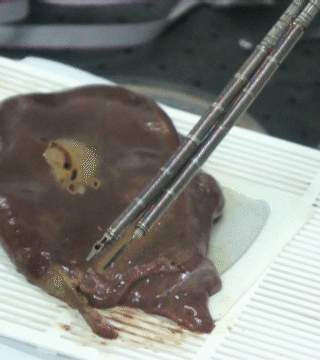 초정밀 수술용 기계