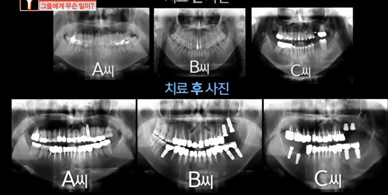 꾸르