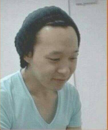 머리 심은 연예인들