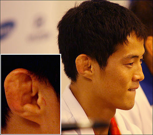 시비 붙으면 안되는 귀