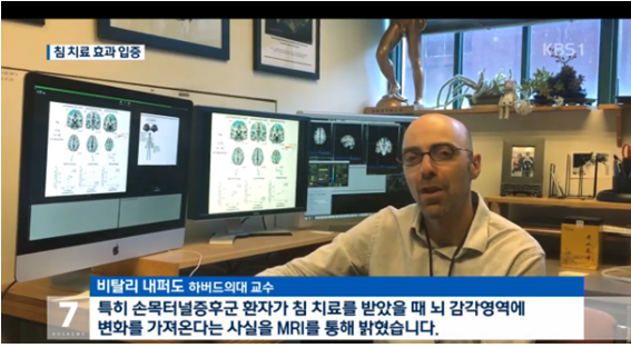 “침 치료로 뇌 구조 변화” 세계 최초 효과 입증