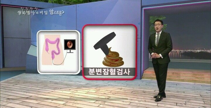 대장내시경을 주기적으로 해야 하는 이유