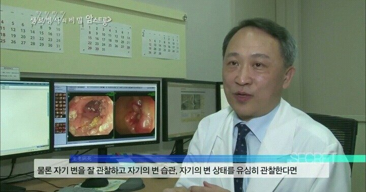 대장내시경을 주기적으로 해야 하는 이유