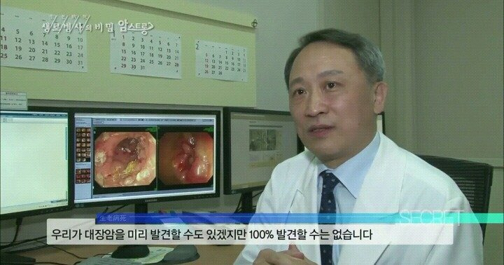 대장내시경을 주기적으로 해야 하는 이유