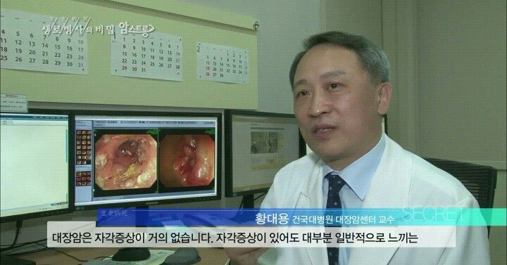 대장내시경을 주기적으로 해야 하는 이유