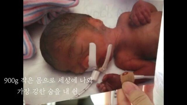 pic_029.jpg 임신 26주차, 미국에서 직장암 판정을 받고 한국에 왔습니다