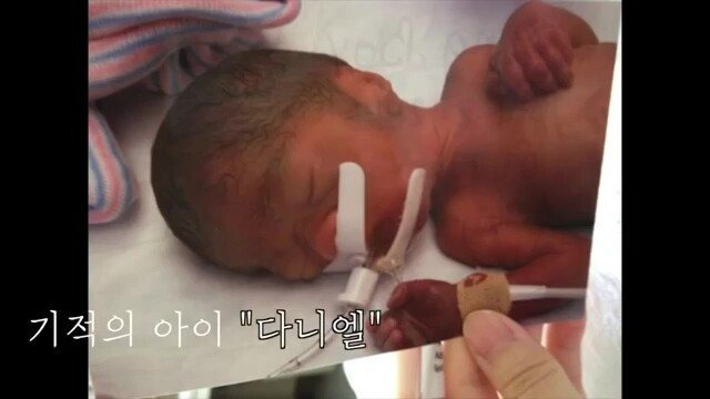 pic_030.jpg 임신 26주차, 미국에서 직장암 판정을 받고 한국에 왔습니다