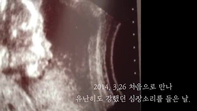 pic_007.jpg 임신 26주차, 미국에서 직장암 판정을 받고 한국에 왔습니다