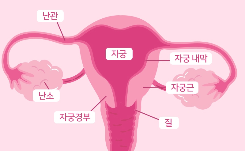 폐경 여성의 암 ‘자궁내막암’의 효과적인 예방법