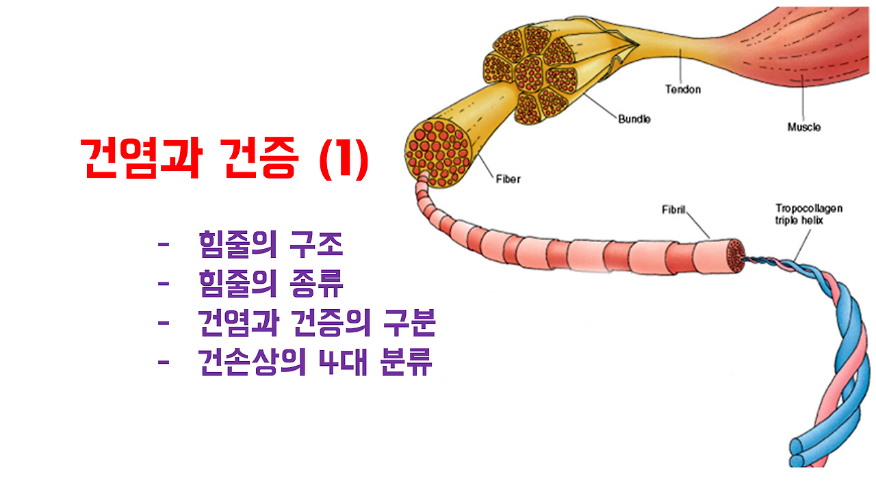 건염과 건증 1