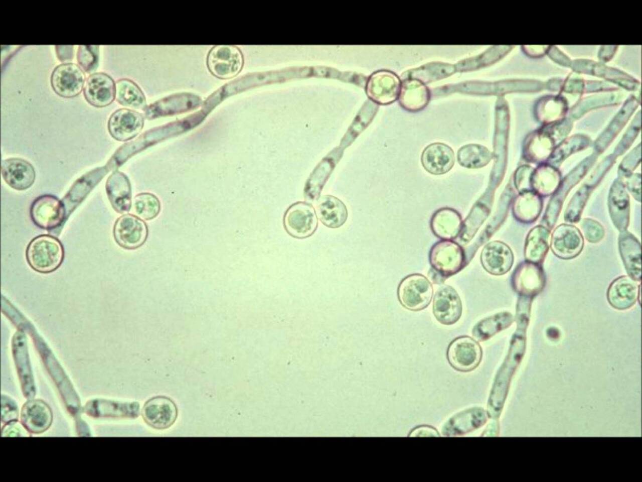 常見細菌可以用普通光學顯微鏡看到嗎？ - GetIt01