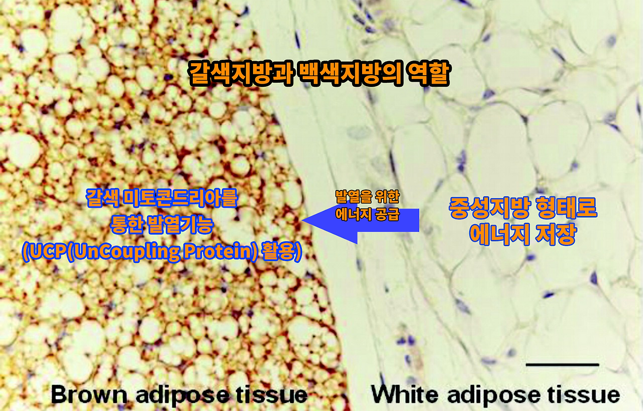 갈색지방과 백색지방의 차이
