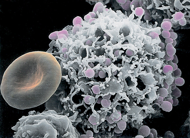 〈사진 4〉 쥐의 복강에서 모은 비만세포에 히스타민 유리제(遊離劑)를 투여하고 5분 뒤에 주사전자현미경으로 들여다본 사진. ×3600