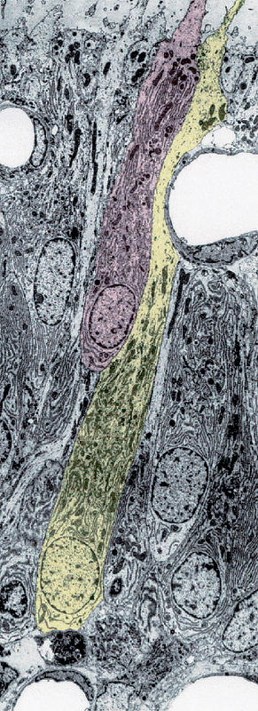 〈사진 3〉 형성 중인 치아의 상아아세포. 쥐. ×1800
