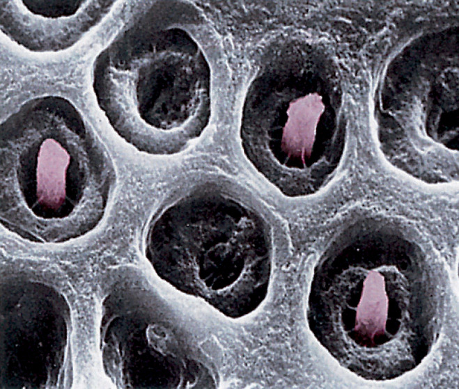〈사진 5〉 상아세관(象牙細管) 안의 톰스섬유(핑크). 상아질을 절단하여 주사전자현미경으로 들여다본 사진. ×3000