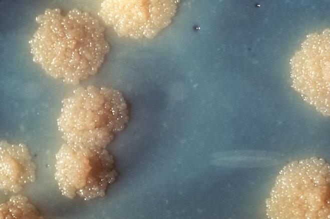 결핵균(Mycobacterium tuberculosis)