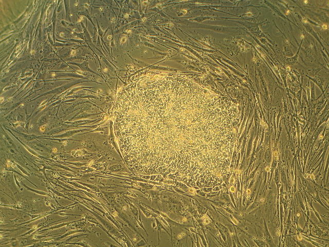 배아줄기세포(embryonic stem cell)