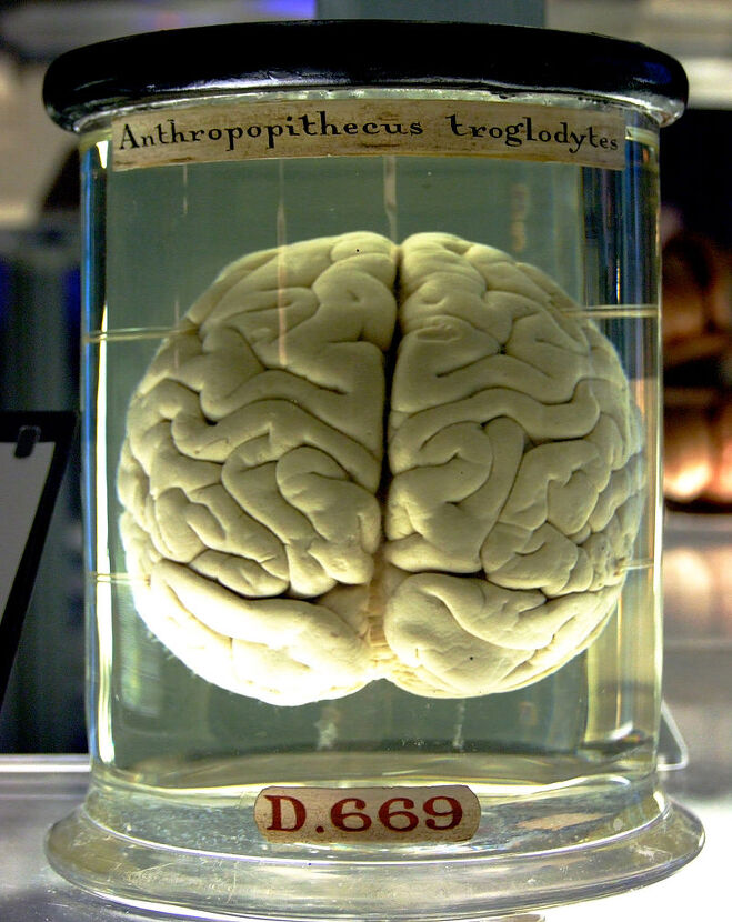 뇌(brain)
