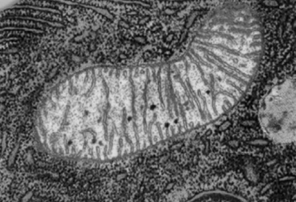 미토콘드리아의 전자 현미경 사진