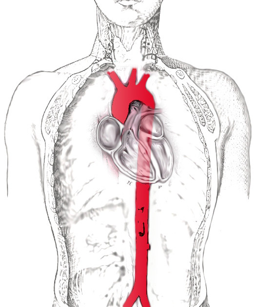 대동맥(aorta)