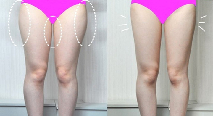 How to get rid of the fat on men's thighs women's body movement Recommended