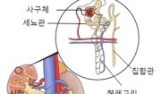 신증후군