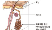 한선염