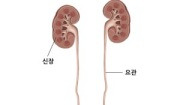 급성 방광염