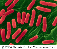 그 유명한 E.coli O157 H7